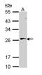 RAN, Member RAS Oncogene Family antibody, LS-C109538, Lifespan Biosciences, Western Blot image 