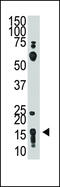 Thy-1 Cell Surface Antigen antibody, 61-007, ProSci, Western Blot image 