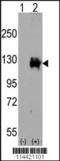 Transient Receptor Potential Cation Channel Subfamily M Member 8 antibody, TA302226, Origene, Western Blot image 