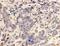 Matrix Metallopeptidase 13 antibody, orb214263, Biorbyt, Immunohistochemistry paraffin image 