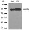 Ribosomal Protein S6 Kinase A1 antibody, AP02663PU-N, Origene, Western Blot image 