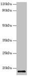 Interferon Gamma antibody, orb241385, Biorbyt, Western Blot image 