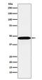 Adenosylhomocysteinase antibody, M04236, Boster Biological Technology, Western Blot image 