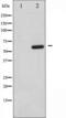 Mitogen-Activated Protein Kinase Kinase Kinase 7 antibody, TA325649, Origene, Western Blot image 
