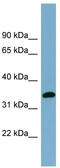 Acyl-CoA Wax Alcohol Acyltransferase 1 antibody, TA336100, Origene, Western Blot image 