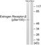 Estrogen Receptor 2 antibody, LS-C198936, Lifespan Biosciences, Western Blot image 