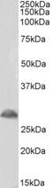 Triggering Receptor Expressed On Myeloid Cells 2 antibody, NBP1-44067, Novus Biologicals, Western Blot image 