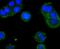 Acyl-CoA Synthetase Short Chain Family Member 2 antibody, NBP2-67003, Novus Biologicals, Immunocytochemistry image 