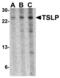 Thymic Stromal Lymphopoietin antibody, MBS150090, MyBioSource, Western Blot image 