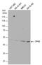 Tryptophan Hydroxylase 2 antibody, PA5-27584, Invitrogen Antibodies, Western Blot image 