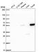 Peroxisome Proliferator Activated Receptor Alpha antibody, HPA067049, Atlas Antibodies, Western Blot image 