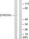 Sterol 26-hydroxylase, mitochondrial antibody, TA313741, Origene, Western Blot image 