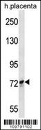 SCY1 Like Pseudokinase 1 antibody, 62-735, ProSci, Western Blot image 