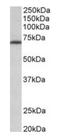 Methylenetetrahydrofolate Reductase antibody, orb125225, Biorbyt, Western Blot image 