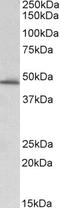 Serpin Family E Member 1 antibody, EB06720, Everest Biotech, Western Blot image 