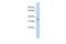 Chromosome 1 Open Reading Frame 116 antibody, GTX47133, GeneTex, Western Blot image 