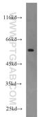 Forkhead Box C2 antibody, 23066-1-AP, Proteintech Group, Western Blot image 