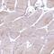 EPS8 Like 2 antibody, PA5-59447, Invitrogen Antibodies, Immunohistochemistry paraffin image 