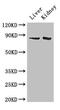 Smoothened, Frizzled Class Receptor antibody, CSB-PA857876LA01HU, Cusabio, Western Blot image 