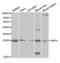 Retinol Binding Protein 4 antibody, abx001347, Abbexa, Western Blot image 