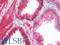 Anterior Gradient 2, Protein Disulphide Isomerase Family Member antibody, LS-B10084, Lifespan Biosciences, Immunohistochemistry paraffin image 