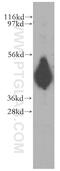 Kazrin, Periplakin Interacting Protein antibody, 11572-1-AP, Proteintech Group, Western Blot image 