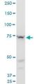 Senataxin antibody, H00023064-M05, Novus Biologicals, Western Blot image 