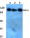 Wolframin ER Transmembrane Glycoprotein antibody, A01326, Boster Biological Technology, Western Blot image 