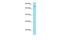 Suppressor Of Cancer Cell Invasion antibody, PA5-70622, Invitrogen Antibodies, Western Blot image 