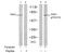 P21 (RAC1) Activated Kinase 1 antibody, GTX78974, GeneTex, Western Blot image 