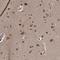 Zinc Finger Protein 518B antibody, HPA031215, Atlas Antibodies, Immunohistochemistry paraffin image 