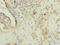 Adaptor Related Protein Complex 1 Subunit Mu 1 antibody, LS-C675382, Lifespan Biosciences, Immunohistochemistry paraffin image 