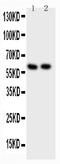 SRC Proto-Oncogene, Non-Receptor Tyrosine Kinase antibody, PB9059, Boster Biological Technology, Western Blot image 