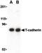 Ectonucleoside Triphosphate Diphosphohydrolase 3 antibody, PA5-20158, Invitrogen Antibodies, Western Blot image 
