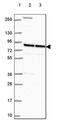 Leucine Zipper Like Transcription Regulator 1 antibody, PA5-64454, Invitrogen Antibodies, Western Blot image 