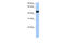 Lin-9 DREAM MuvB Core Complex Component antibody, 30-667, ProSci, Enzyme Linked Immunosorbent Assay image 