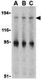 Insulin Receptor Substrate 1 antibody, GTX31717, GeneTex, Western Blot image 