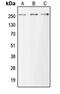 Mucin 6, Oligomeric Mucus/Gel-Forming antibody, GTX56194, GeneTex, Western Blot image 