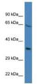 Proline Rich 16 antibody, NBP1-79655, Novus Biologicals, Western Blot image 