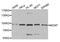 Minichromosome Maintenance Complex Component 7 antibody, MBS126280, MyBioSource, Western Blot image 