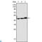 Keratin 17 antibody, LS-C812432, Lifespan Biosciences, Immunohistochemistry paraffin image 