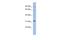 TBC1 Domain Family Member 14 antibody, A10365, Boster Biological Technology, Western Blot image 