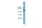 Iroquois-class homeodomain protein IRX-5 antibody, A06896, Boster Biological Technology, Western Blot image 