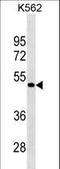 G Protein-Coupled Receptor 39 antibody, LS-C159771, Lifespan Biosciences, Western Blot image 