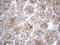 Interferon Lambda Receptor 1 antibody, LS-C793057, Lifespan Biosciences, Immunohistochemistry paraffin image 