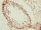 N-Myristoyltransferase 2 antibody, LS-C676170, Lifespan Biosciences, Immunohistochemistry paraffin image 