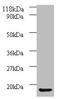 Adaptor Related Protein Complex 1 Subunit Sigma 3 antibody, orb240699, Biorbyt, Western Blot image 