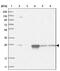 Proteasome Subunit Alpha 5 antibody, NBP1-86837, Novus Biologicals, Western Blot image 