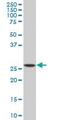 SPINK1 antibody, ab88082, Abcam, Western Blot image 