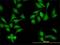 NIMA Related Kinase 9 antibody, H00091754-M01, Novus Biologicals, Immunocytochemistry image 